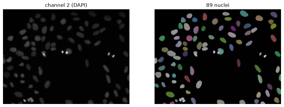 <Figure size 1200x600 with 2 Axes>