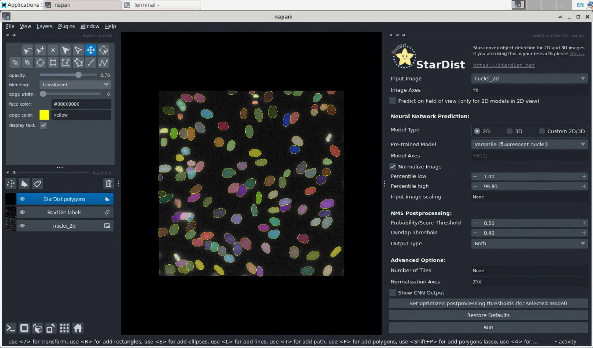 StarDist segmentation in napari